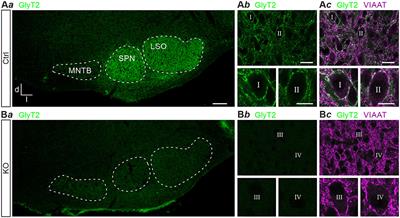 Glycinergic Transmission in the Presence and Absence of Functional GlyT2: Lessons From the Auditory Brainstem